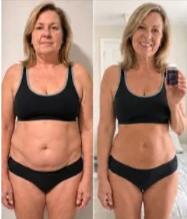 Olivia Bennett Denver CO LipoMeltX Review