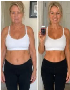 Madison Brooks Charlotte NC LipoMeltX Review