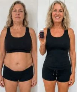 Rachel Foster Orlando FL LipoMeltX Review